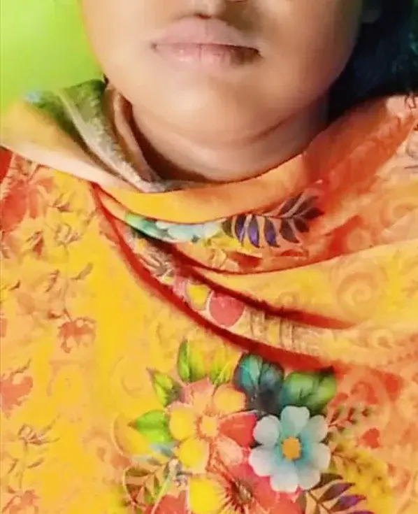 Nus_Rat3344