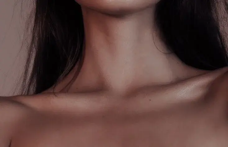 Kionela